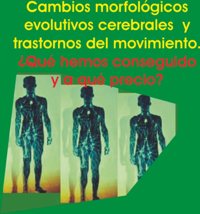 Trastornos del movimiento